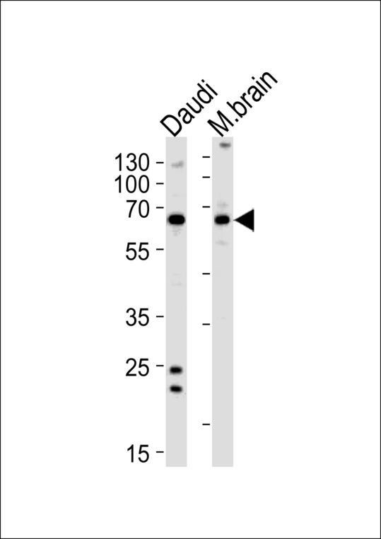 PACSIN2 Antibody (S357) western blot of Daudi cell line and mouse brain lysates (35 ug/lane). The PACSIN2 antibody detected the PACSIN2 protein (arrow).