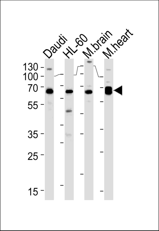 PACSIN2 Antibody (S357) western blot of Daudi,HL-60 cell line and mouse brain,rat heart lysates (35 ug/lane). The PACSIN2 antibody detected the PACSIN2 protein (arrow).