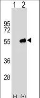 Western blot of PACSIN3 (arrow) using rabbit polyclonal PACSIN3 Antibody (M1). 293 cell lysates (2 ug/lane) either nontransfected (Lane 1) or transiently transfected (Lane 2) with the PACSIN3 gene.