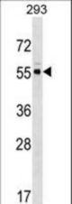 PACSIN3 Antibody (M1) western blot of 293 cell line lysates (35 ug/lane). The PACSIN3 antibody detected the PACSIN3 protein (arrow).