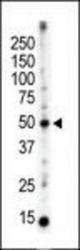 The anti-PACSIN3 antibody is used in Western blot to detect PACSIN3 in mouse brain tissue lysate.