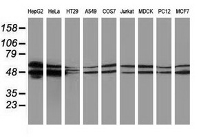 Western blot of extracts (35 ug) from 9 different cell lines by using anti-PACSIN3 monoclonal antibody.