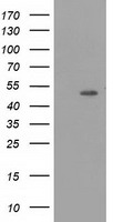 HEK293T cells were transfected with the pCMV6-ENTRY control (Left lane) or pCMV6-ENTRY PACSIN3 (Right lane) cDNA for 48 hrs and lysed. Equivalent amounts of cell lysates (5 ug per lane) were separated by SDS-PAGE and immunoblotted with anti-PACSIN3.