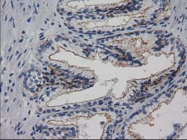 IHC of paraffin-embedded Human prostate tissue using anti-PACSIN3 mouse monoclonal antibody.