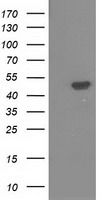 HEK293T cells were transfected with the pCMV6-ENTRY control (Left lane) or pCMV6-ENTRY PACSIN3 (Right lane) cDNA for 48 hrs and lysed. Equivalent amounts of cell lysates (5 ug per lane) were separated by SDS-PAGE and immunoblotted with anti-PACSIN3.