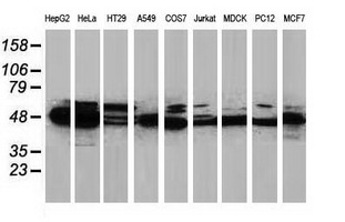 Western blot of extracts (35 ug) from 9 different cell lines by using anti-PACSIN3 monoclonal antibody.
