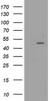 HEK293T cells were transfected with the pCMV6-ENTRY control (Left lane) or pCMV6-ENTRY PACSIN3 (Right lane) cDNA for 48 hrs and lysed. Equivalent amounts of cell lysates (5 ug per lane) were separated by SDS-PAGE and immunoblotted with anti-PACSIN3.