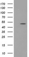 HEK293T cells were transfected with the pCMV6-ENTRY control (Left lane) or pCMV6-ENTRY PACSIN3 (Right lane) cDNA for 48 hrs and lysed. Equivalent amounts of cell lysates (5 ug per lane) were separated by SDS-PAGE and immunoblotted with anti-PACSIN3.