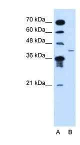 MFAP3L antibody LS-C40486 Western blot of Jurkat lysate.