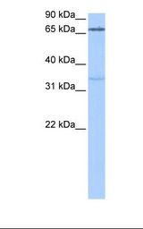 Jurkat cell lysate. Antibody concentration: 0.5 ug/ml. Gel concentration: 12%.