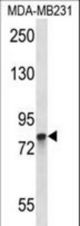 PADI2 Antibody western blot of MDA-MB231 cell line lysates (35 ug/lane). The PADI2 antibody detected the PADI2 protein (arrow).