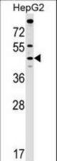 MCAT Antibody western blot of HepG2 cell line lysates (35 ug/lane). The MCAT antibody detected the MCAT protein (arrow).
