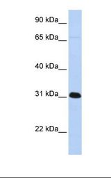 HepG2 cell lysate. Antibody concentration: 1.0 ug/ml. Gel concentration: 12%.