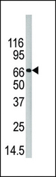Western blot of anti-PAD4 antibody in 293 cell line lysate. PAD4(arrow) was detected using the purified antibody.