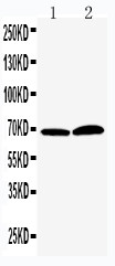 WB of PADI4 / PAD4 antibody. Lane 1: PANC Cell Lysate. Lane 2: 293T Cell Lysate..