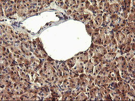 IHC of paraffin-embedded Human pancreas tissue using anti-PADI4 mouse monoclonal antibody.