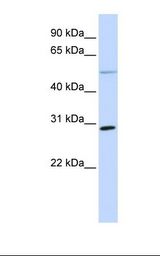 MCF7 cell lysate. Antibody concentration: 1.0 ug/ml. Gel concentration: 12%.