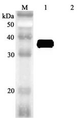 Western blot analysis using anti-MFAP4 (human), pAb at 1:2000 dilution. 1: Human MFAP4 (FLAG-tagged). 2: Mouse RBP4 (FLAG-tagged) (negative control).