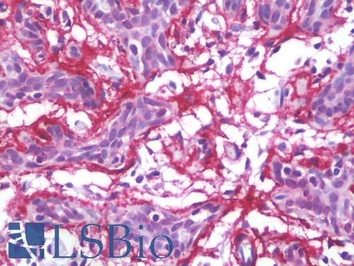 Anti-MFAP4 antibody IHC staining of human breast. Immunohistochemistry of formalin-fixed, paraffin-embedded tissue after heat-induced antigen retrieval. Antibody LS-B9669 concentration 10 ug/ml.
