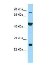 Western blot of Human RPMI-8226. PADI6 antibody dilution 1.0 ug/ml.