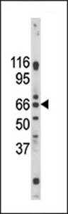 Western blot of anti-Pael-R (GPR37) antibody in mouse brain tissue lysate. Pael-R (GPR37) (arrow) was detected using the purified antibody.