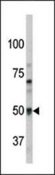 Western blot of anti-Pael-R (GPR37) antibody in mouse brain tissue lysate. Pael-R (GPR37) (arrow) was detected using the purified antibody.