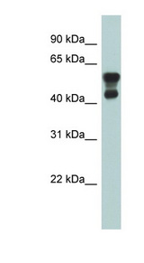 PAFAH1B1 / LIS1 antibody LS-C111803 Western blot of Fetal Lung lysate.