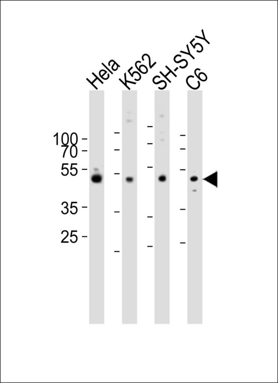 Western blot of lysates from HeLa, K562, SH-SY5Y, rat C6 cell line (from left to right) with PAFAH1B1 Antibody. Antibody was diluted at 1:1000 at each lane. A goat anti-rabbit IgG H&L (HRP) at 1:10000 dilution was used as the secondary antibody. Lysates at 20 ug per lane.