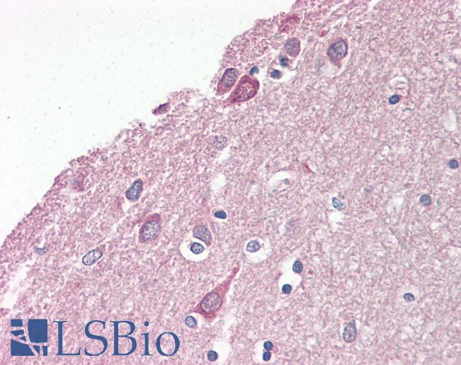Anti-LIS1 antibody IHC of human brain, cortex. Immunohistochemistry of formalin-fixed, paraffin-embedded tissue after heat-induced antigen retrieval. Antibody LS-B8228 dilution 5-7.5 ug/ml.