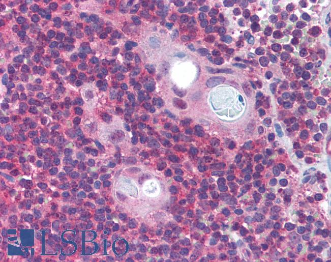 Anti-PAFAH1B1 / LIS1 antibody IHC of human thymus. Immunohistochemistry of formalin-fixed, paraffin-embedded tissue after heat-induced antigen retrieval. Antibody LS-B1383 concentration 5 ug/ml.