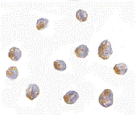 Immunocytochemistry of LIS1 in Jurkat cells with LIS1 antibody at 2.5 ug/ml.