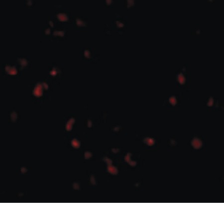 Immunofluorescence of LIS1 in Jurkat cells with LIS1 antibody at 20 ug/ml.