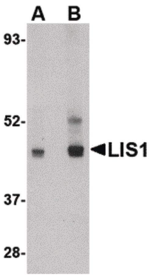 Western blot of LIS1 in HeLa cell lysate with LIS1 antibody at (A) 0.5 and (B) 1 ug/ml.