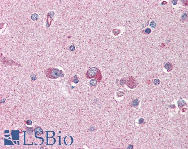 Anti-PAFAH1B1 / LIS1 antibody IHC of human brain, cortex. Immunohistochemistry of formalin-fixed, paraffin-embedded tissue after heat-induced antigen retrieval. Antibody LS-B3029 concentration 75 ug/ml.