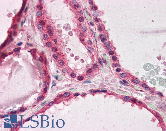 Anti-PAFAH1B1 / LIS1 antibody IHC of human thyroid. Immunohistochemistry of formalin-fixed, paraffin-embedded tissue after heat-induced antigen retrieval. Antibody LS-B3029 concentration 75 ug/ml.