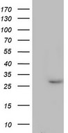 HEK293T cells were transfected with the pCMV6-ENTRY control (Left lane) or pCMV6-ENTRY PAFAH1B3 (Right lane) cDNA for 48 hrs and lysed. Equivalent amounts of cell lysates (5 ug per lane) were separated by SDS-PAGE and immunoblotted with anti-PAFAH1B3.