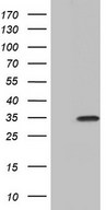 HEK293T cells were transfected with the pCMV6-ENTRY control (Left lane) or pCMV6-ENTRY PAFAH1B3 (Right lane) cDNA for 48 hrs and lysed. Equivalent amounts of cell lysates (5 ug per lane) were separated by SDS-PAGE and immunoblotted with anti-PAFAH1B3.