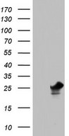 HEK293T cells were transfected with the pCMV6-ENTRY control (Left lane) or pCMV6-ENTRY PAFAH1B3 (Right lane) cDNA for 48 hrs and lysed. Equivalent amounts of cell lysates (5 ug per lane) were separated by SDS-PAGE and immunoblotted with anti-PAFAH1B3.