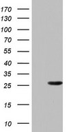 HEK293T cells were transfected with the pCMV6-ENTRY control (Left lane) or pCMV6-ENTRY PAFAH1B3 (Right lane) cDNA for 48 hrs and lysed. Equivalent amounts of cell lysates (5 ug per lane) were separated by SDS-PAGE and immunoblotted with anti-PAFAH1B3.