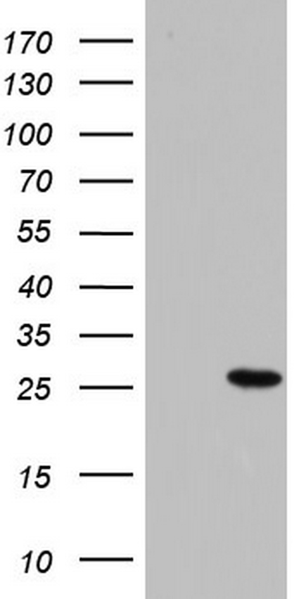 HEK293T cells were transfected with the pCMV6-ENTRY control (Left lane) or pCMV6-ENTRY PAFAH1B3 (Right lane) cDNA for 48 hrs and lysed. Equivalent amounts of cell lysates (5 ug per lane) were separated by SDS-PAGE and immunoblotted with anti-PAFAH1B3.