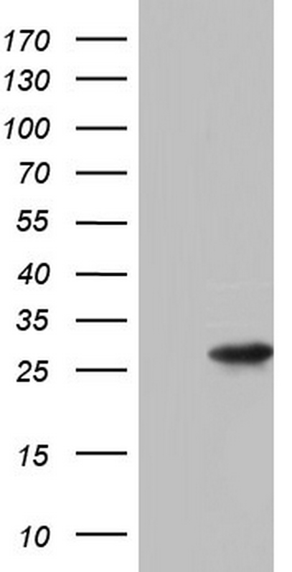 HEK293T cells were transfected with the pCMV6-ENTRY control (Left lane) or pCMV6-ENTRY PAFAH1B3 (Right lane) cDNA for 48 hrs and lysed. Equivalent amounts of cell lysates (5 ug per lane) were separated by SDS-PAGE and immunoblotted with anti-PAFAH1B3.