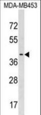 PAFAH2 Antibody western blot of MDA-MB453 cell line lysates (35 ug/lane). The PAFAH2 antibody detected the PAFAH2 protein (arrow).