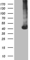 HEK293T cells were transfected with the pCMV6-ENTRY control (Left lane) or pCMV6-ENTRY PAGE1 (Right lane) cDNA for 48 hrs and lysed. Equivalent amounts of cell lysates (5 ug per lane) were separated by SDS-PAGE and immunoblotted with anti-PAGE1.