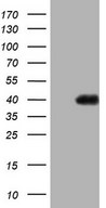 HEK293T cells were transfected with the pCMV6-ENTRY control (Left lane) or pCMV6-ENTRY PAGE1 (Right lane) cDNA for 48 hrs and lysed. Equivalent amounts of cell lysates (5 ug per lane) were separated by SDS-PAGE and immunoblotted with anti-PAGE1.