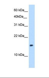 721_B cell lysate. Antibody concentration: 5.0 ug/ml. Gel concentration: 15%.