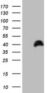 HEK293T cells were transfected with the pCMV6-ENTRY control (Left lane) or pCMV6-ENTRY PAGE1 (Right lane) cDNA for 48 hrs and lysed. Equivalent amounts of cell lysates (5 ug per lane) were separated by SDS-PAGE and immunoblotted with anti-PAGE1.