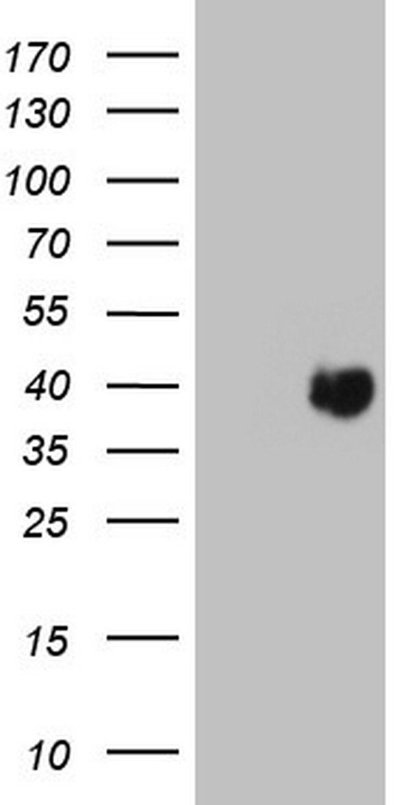 HEK293T cells were transfected with the pCMV6-ENTRY control (Left lane) or pCMV6-ENTRY PAGE1 (Right lane) cDNA for 48 hrs and lysed. Equivalent amounts of cell lysates (5 ug per lane) were separated by SDS-PAGE and immunoblotted with anti-PAGE1.