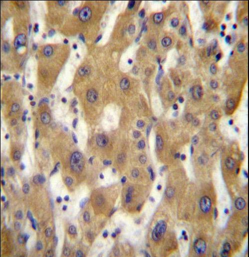 PAGE5 Antibody immunohistochemistry of formalin-fixed and paraffin-embedded human liver tissue followed by peroxidase-conjugated secondary antibody and DAB staining.