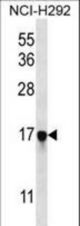 PAGE5 Antibody western blot of NCI-H292 cell line lysates (35 ug/lane). The PAGE5 antibody detected the PAGE5 protein (arrow).