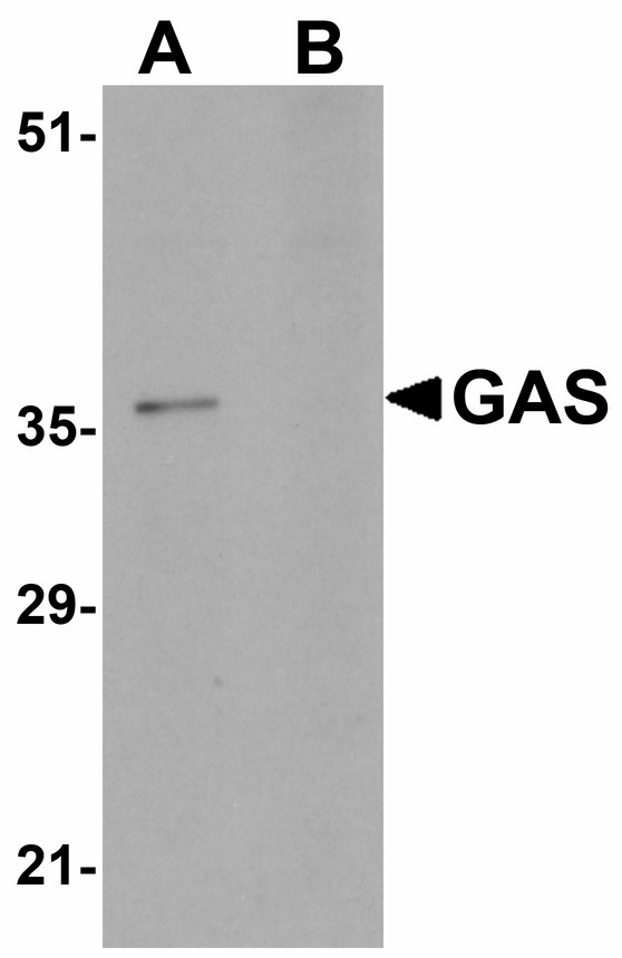 Western blot of GAS in EL4 cell lysate in (A) the absence and (B) the presence of blocking peptide with GAS antibody at 1 ug/ml.